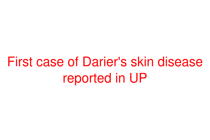 First case of Darier's skin disease reported in UP