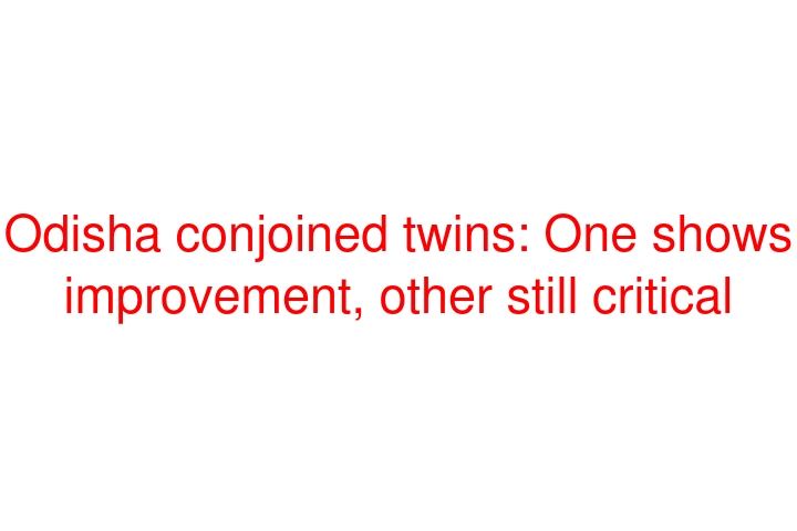 Odisha conjoined twins: One shows improvement, other still critical