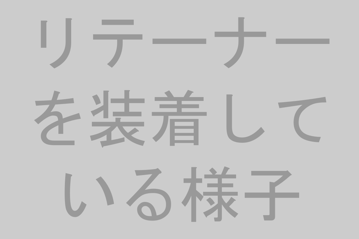 後戻りの予防策