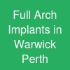 Full Arch Implants in Warwick Perth