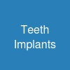 Teeth Implants