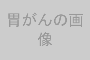胃がんの内視鏡画像