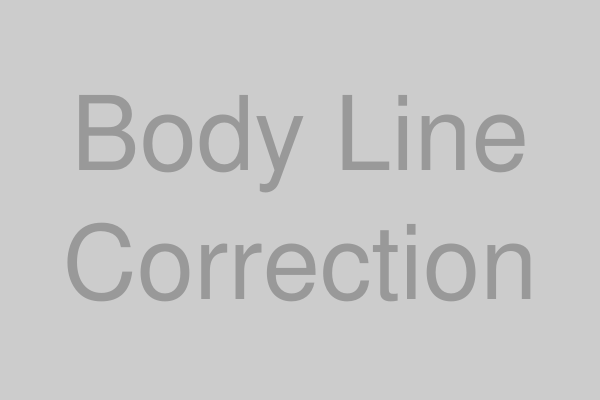 ボディライン矯正のイメージ