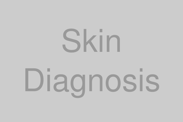 肌診断とプロの提案イメージ